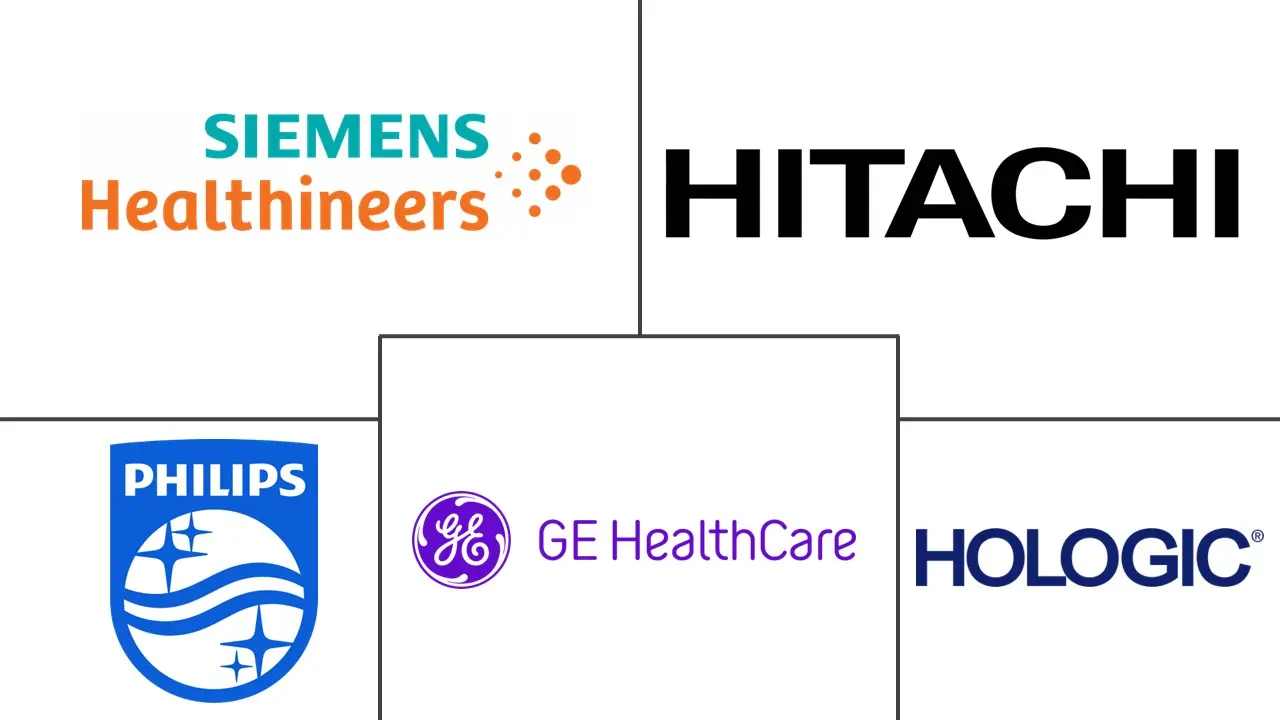 乳腺超声市场规模和份额