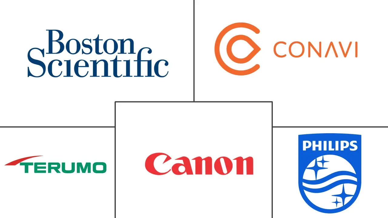 血管内超声 [IVUS] 设备市场规模和份额
