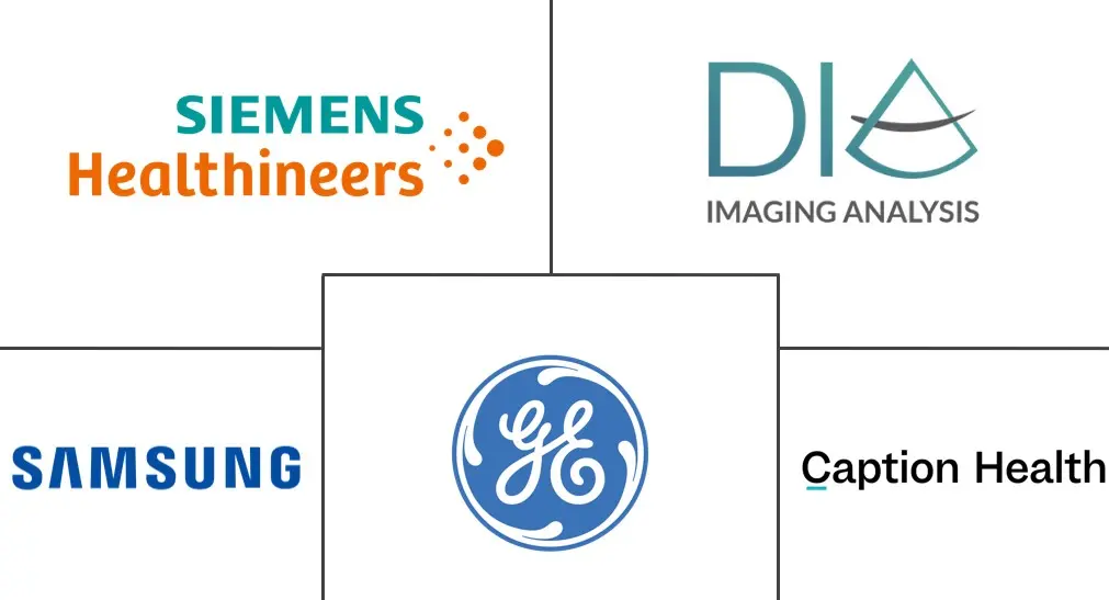 超声成像中的人工智能市场规模和份额